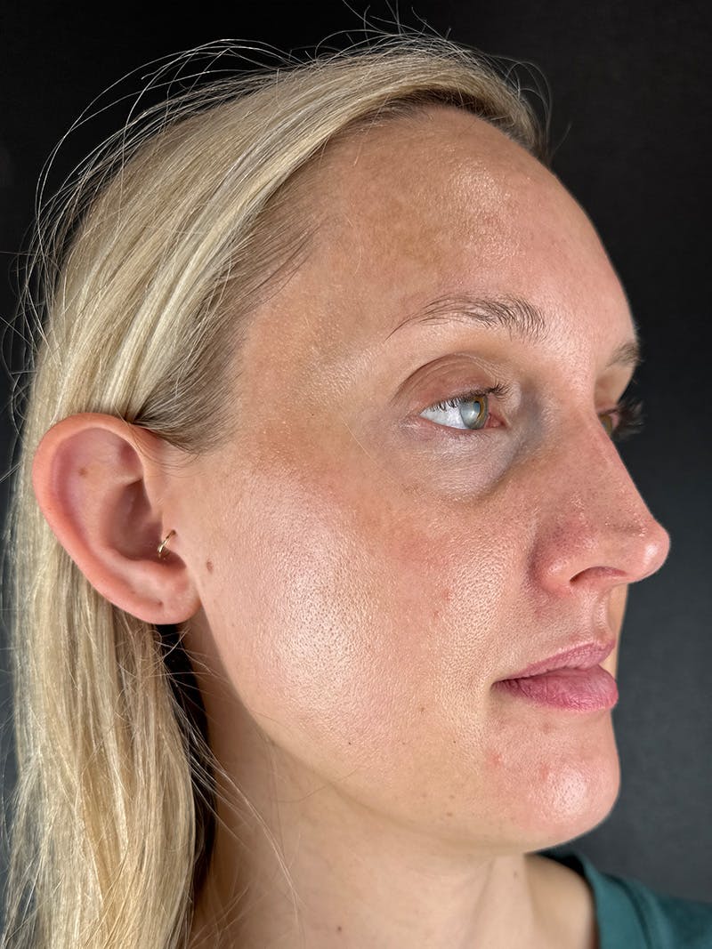 Comprehensive Treatment Plans Before & After Gallery - Patient 103565 - Image 4