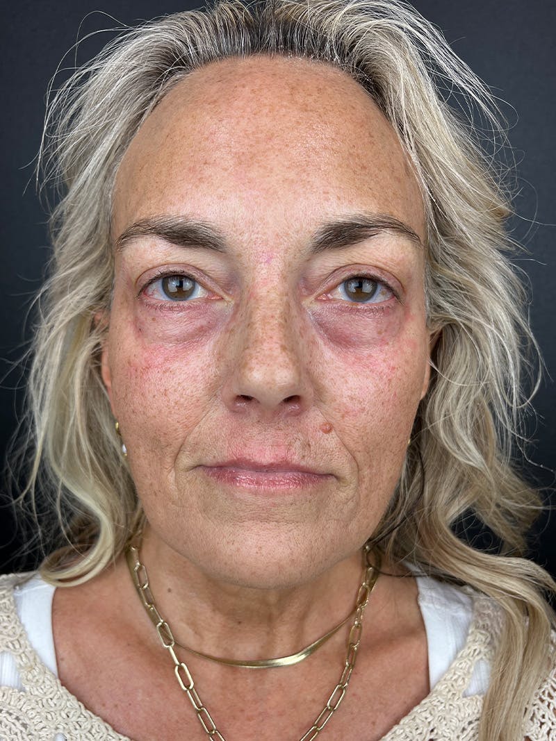 Comprehensive Treatment Plans Before & After Gallery - Patient 767959 - Image 1