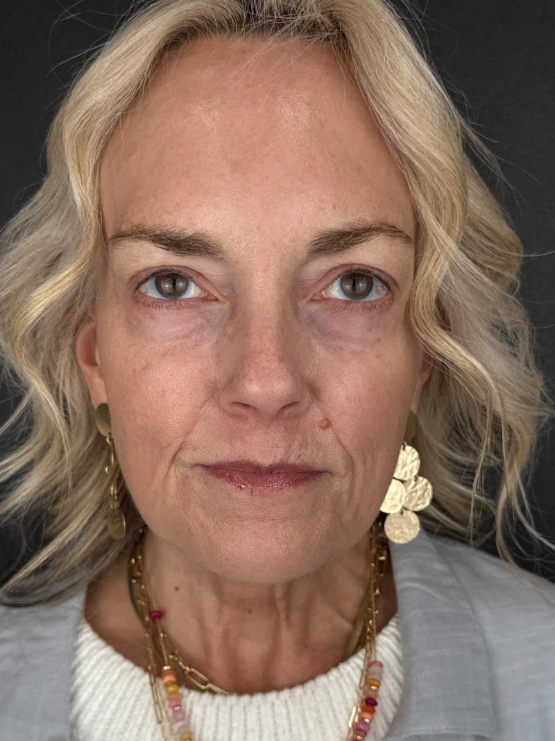 Comprehensive Treatment Plans Before & After Gallery - Patient 767959 - Image 2