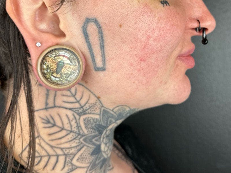  Neck/Submental Liposuction Before & After Gallery - Patient 131788 - Image 2