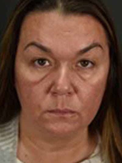 Blepharoplasty (Eyelid Surgery) Before & After Gallery - Patient 353501 - Image 1