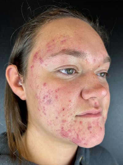 Comprehensive Treatment Plans Before & After Gallery - Patient 280725 - Image 1