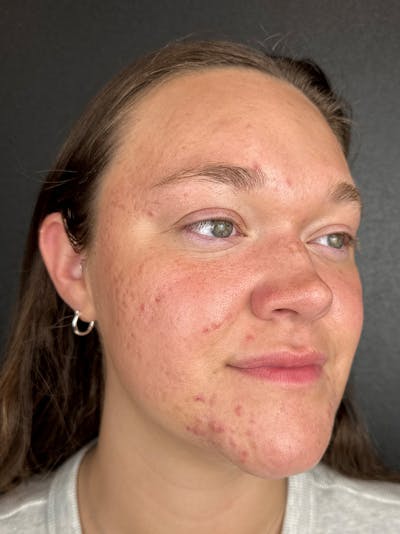 Comprehensive Treatment Plans Before & After Gallery - Patient 280725 - Image 2
