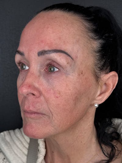 Comprehensive Treatment Plans Before & After Gallery - Patient 784173 - Image 1