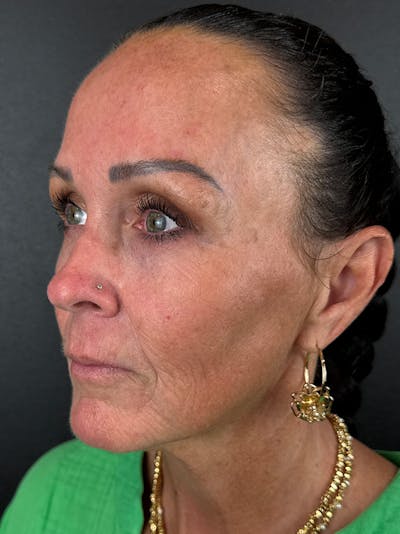 Comprehensive Treatment Plans Before & After Gallery - Patient 784173 - Image 2