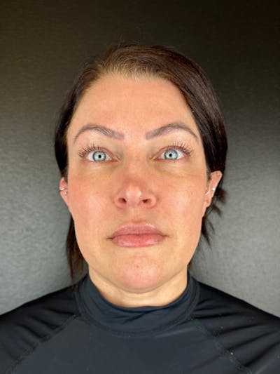 Comprehensive Treatment Plans Before & After Gallery - Patient 299186 - Image 2