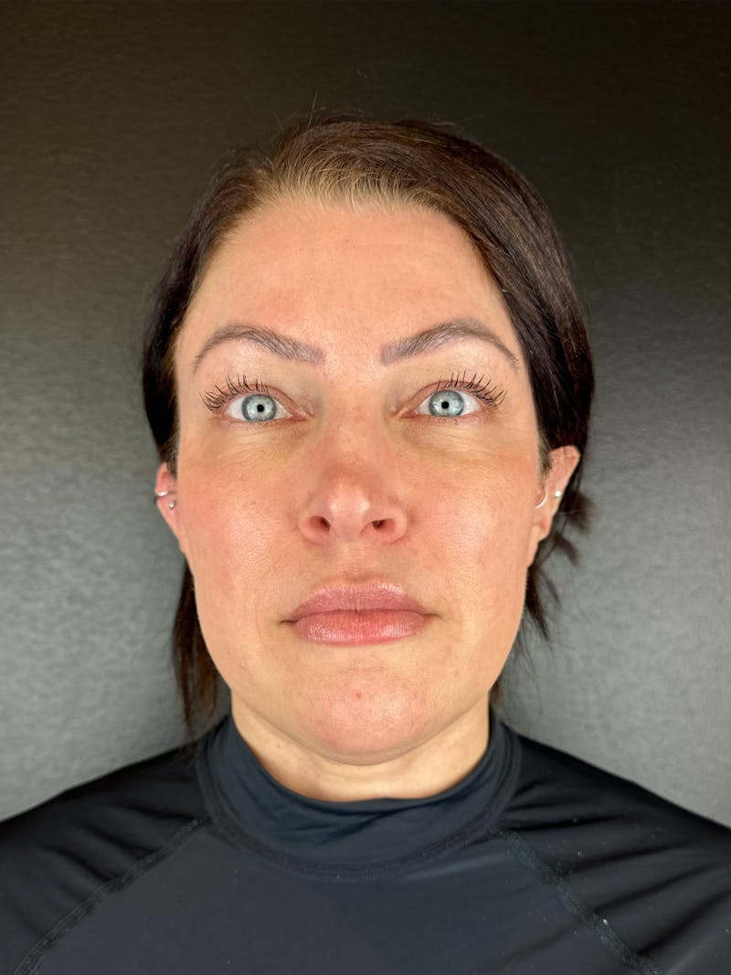 Comprehensive Treatment Plans Before & After Gallery - Patient 299186 - Image 2