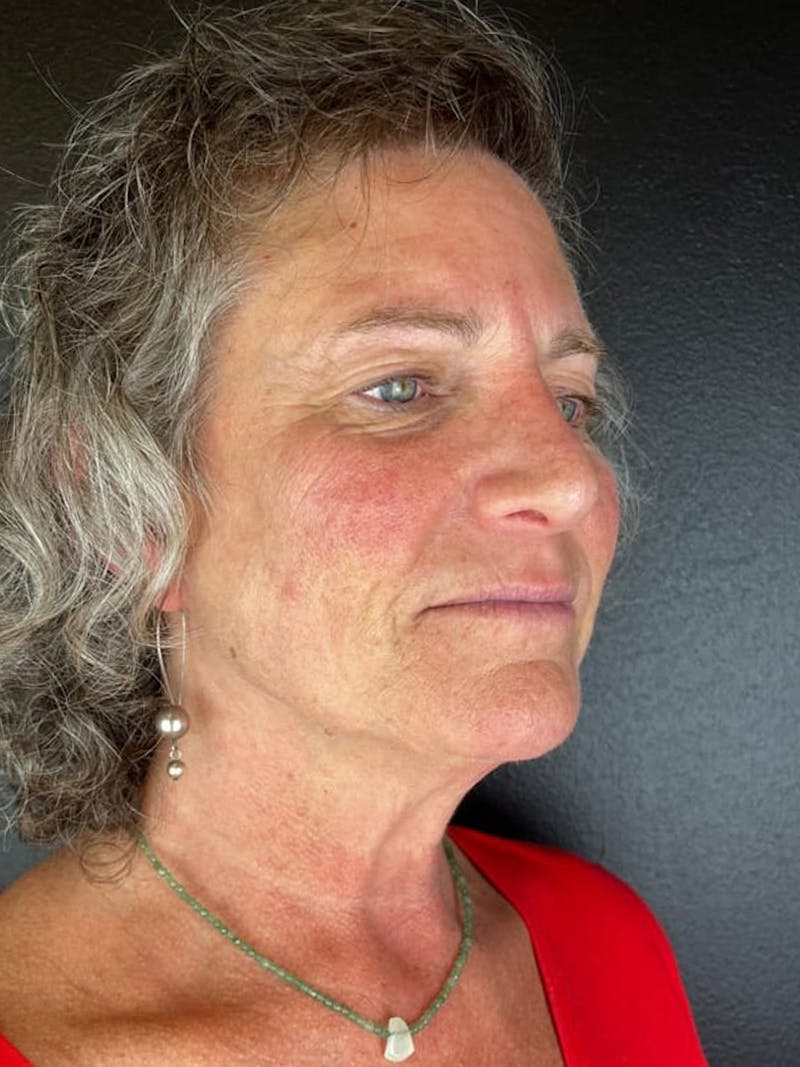 Comprehensive Treatment Plans Before & After Gallery - Patient 343538 - Image 1