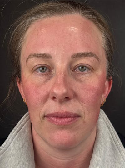 Comprehensive Treatment Plans Before & After Gallery - Patient 119986 - Image 1