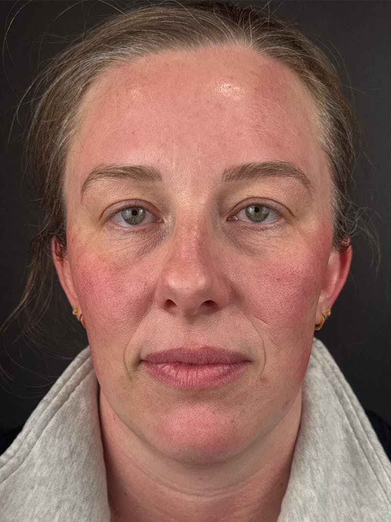 Comprehensive Treatment Plans Before & After Gallery - Patient 119986 - Image 1