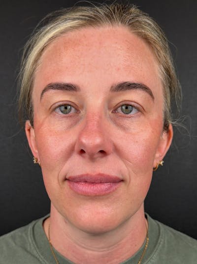 Comprehensive Treatment Plans Before & After Gallery - Patient 119986 - Image 2