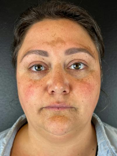 Comprehensive Treatment Plans Before & After Gallery - Patient 132508 - Image 1