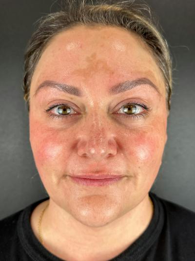 Comprehensive Treatment Plans Before & After Gallery - Patient 132508 - Image 2