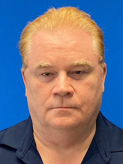 Male Face & Neck Before & After Gallery - Patient 115786 - Image 1