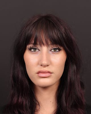 Primary Rhinoplasty Before & After Gallery - Patient 420494 - Image 4