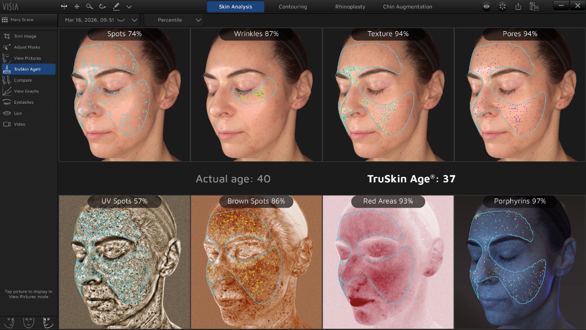 Skin Evaluation Analysis in Miami | Canfield Visia Device | Dr