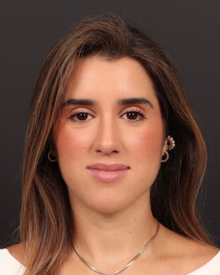 Primary Rhinoplasty Before & After Gallery - Patient 516119 - Image 4