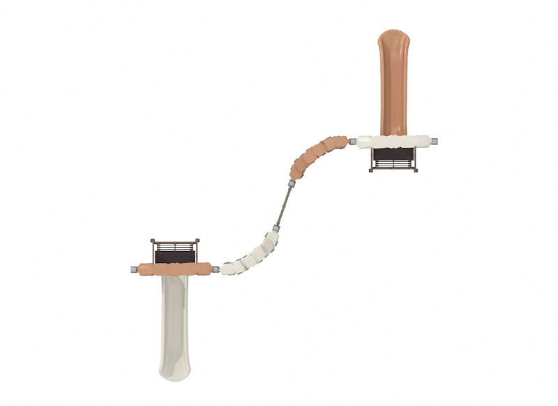 Klätterställning Quinin