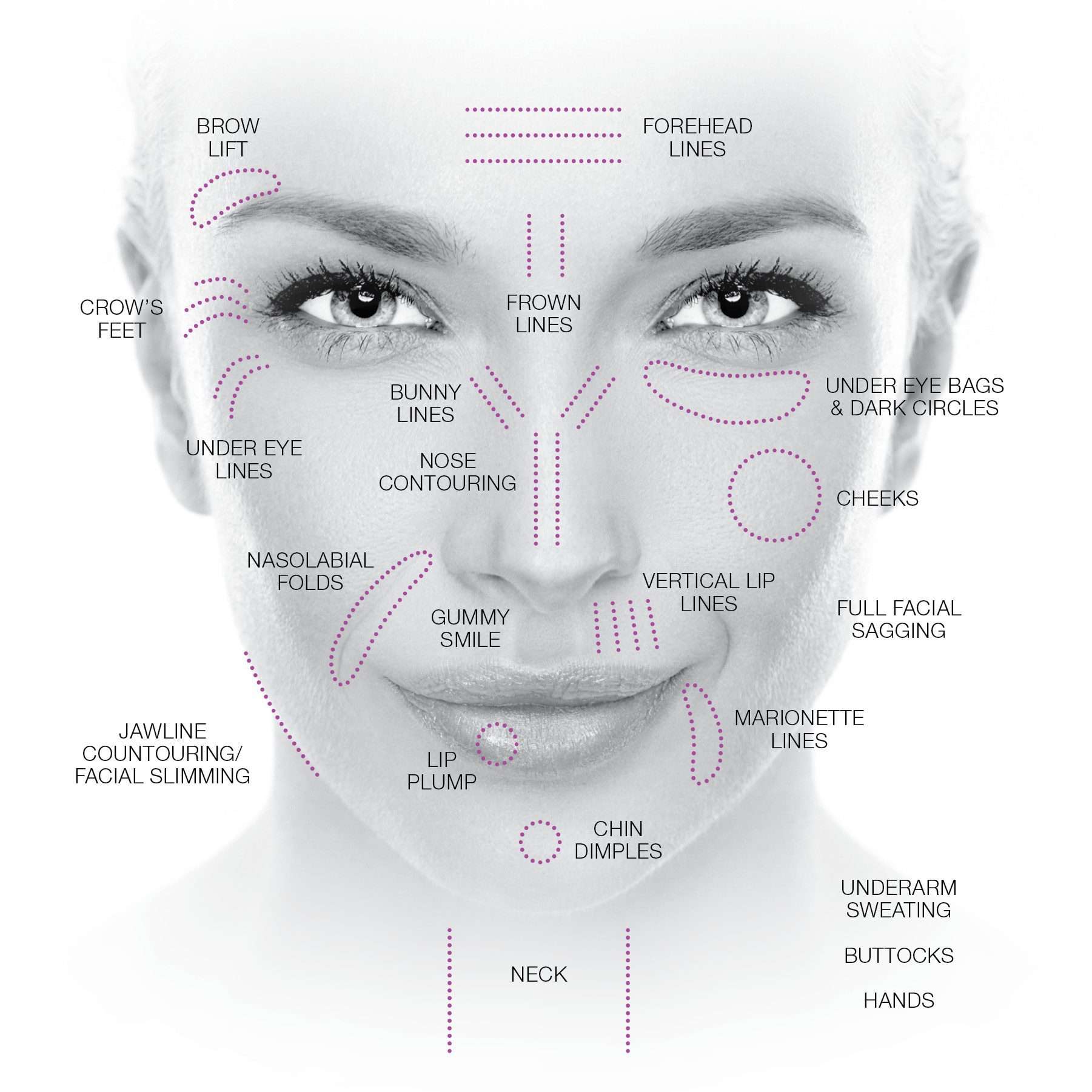 Infographic