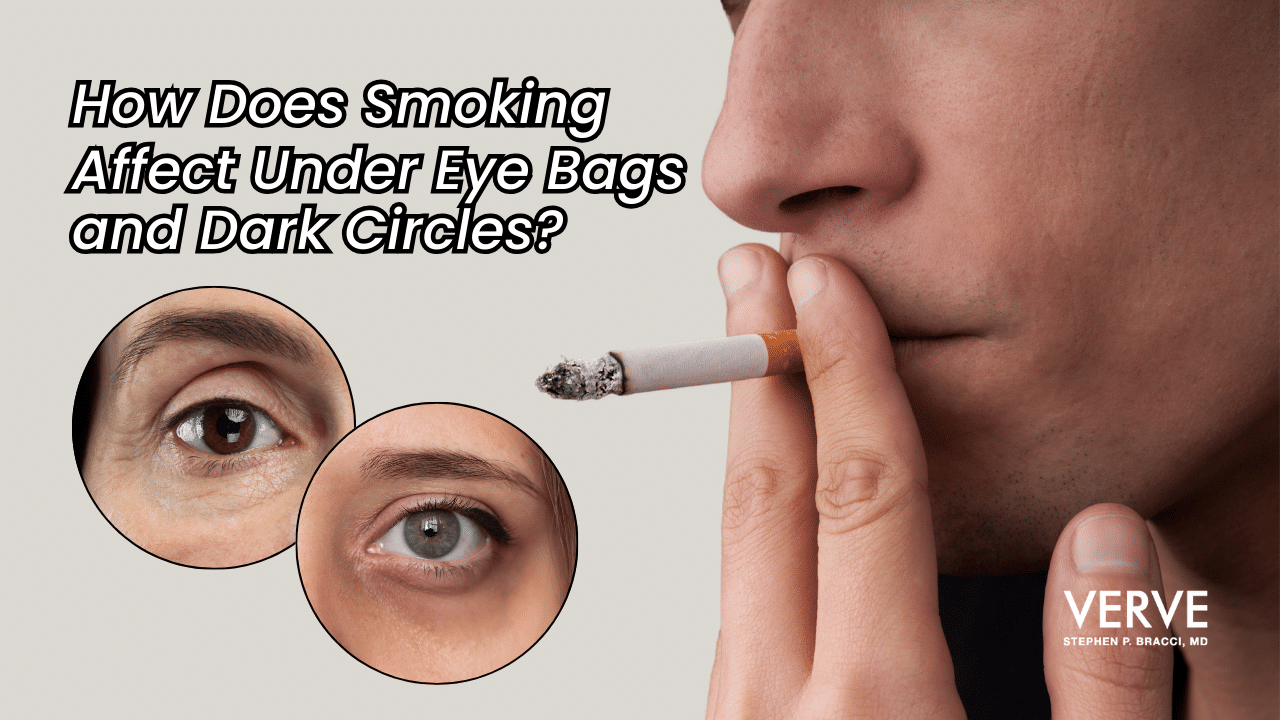 How Does Smoking Affect Under Eye Bags and Dark Circles? - Verve Medical  Cosmetics