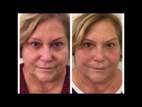 VERVE Medical Cosmetics