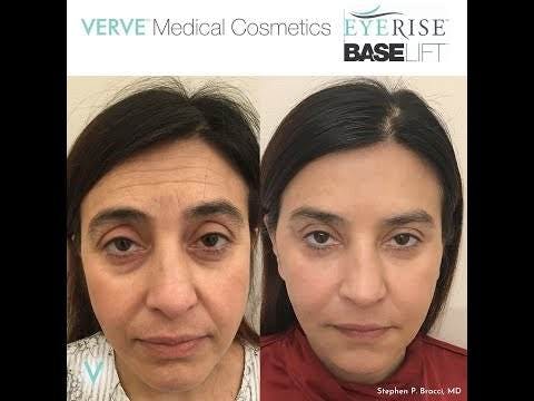 VERVE Medical Cosmetics