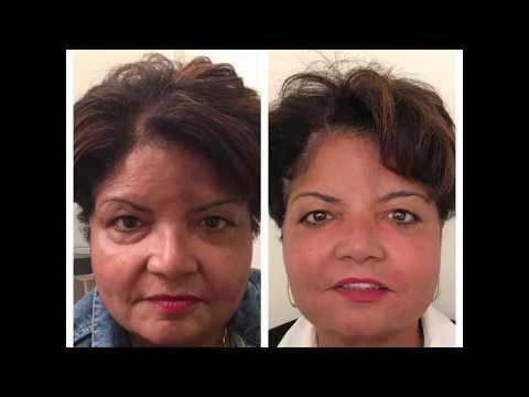 VERVE Medical Cosmetics