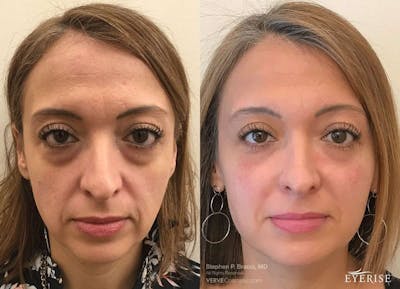 before and after images