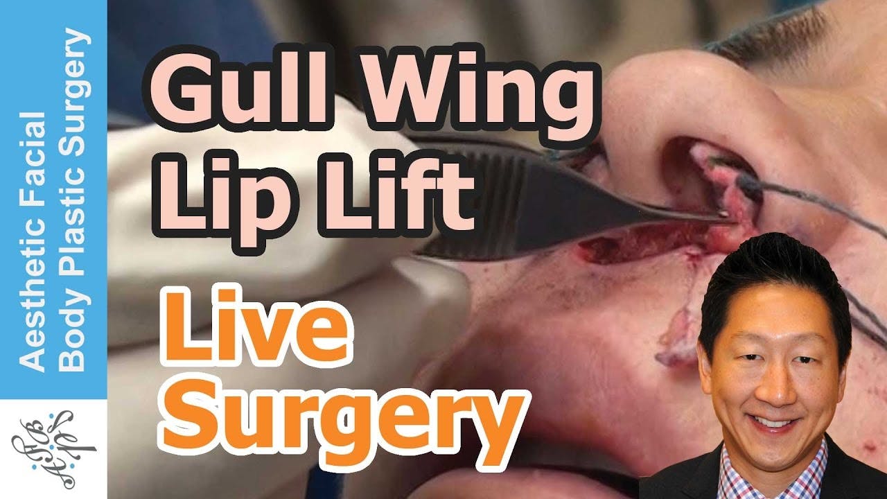 lip lift video