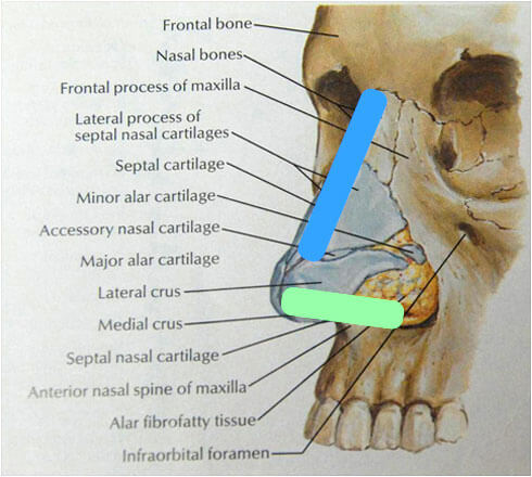 infographic