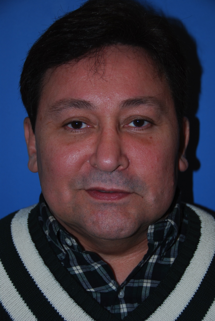Patient facing Frontal View