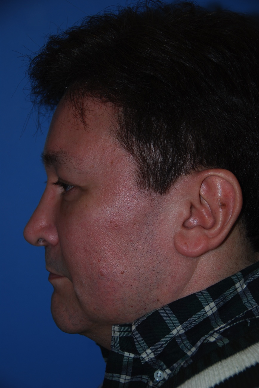 Patient facing Left Lateral View