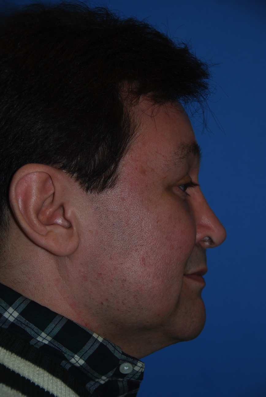 Patient facing Right Lateral View