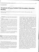 Treatment of Large
