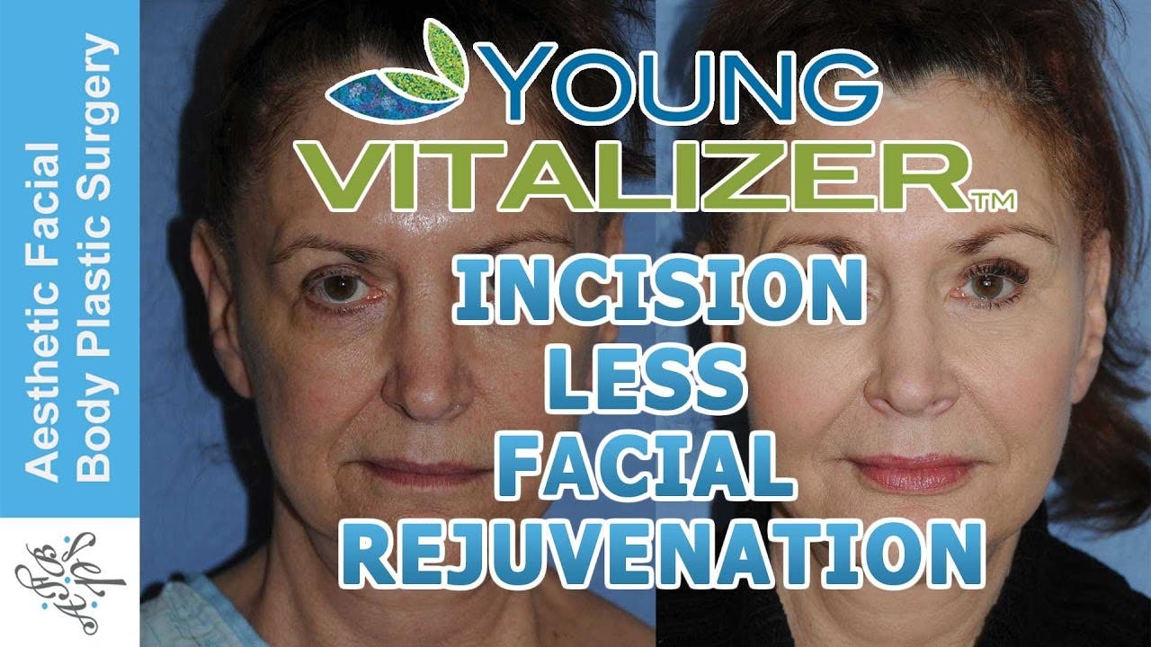 Video Thumbnail