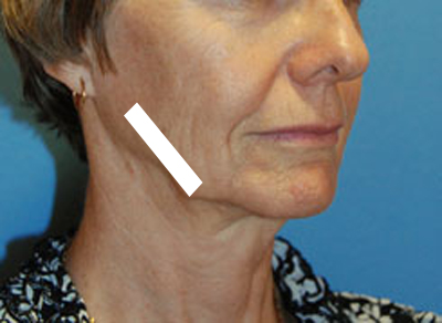 after image