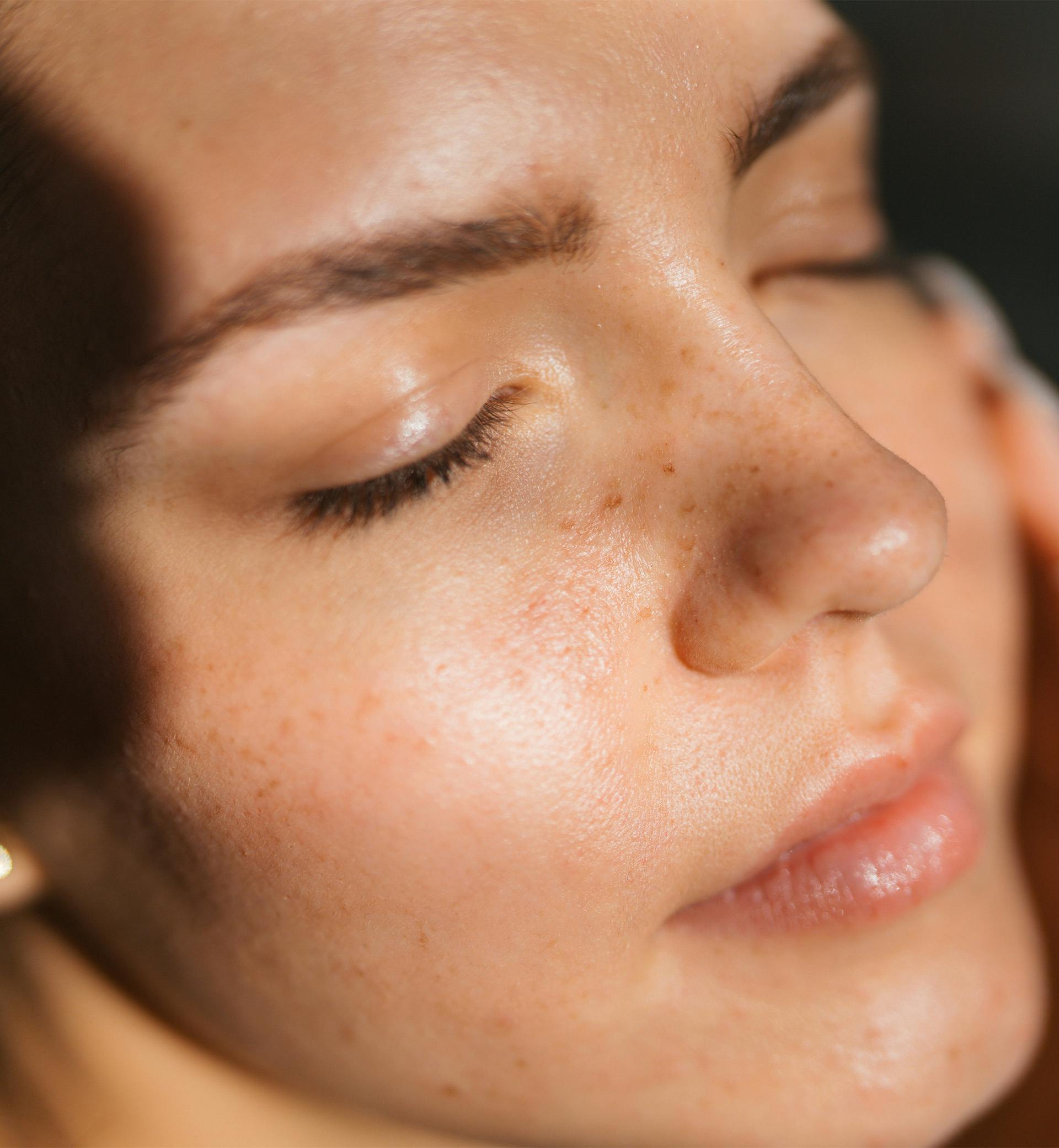 woman touching her face