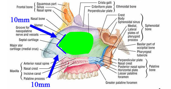Below are images of the internal nasal structures: