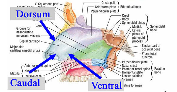 rhinoplasty diagram