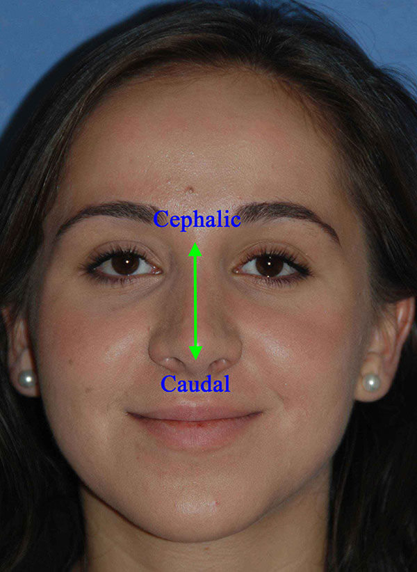 face diagram
