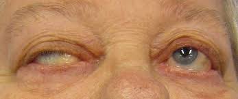 A women's eyes