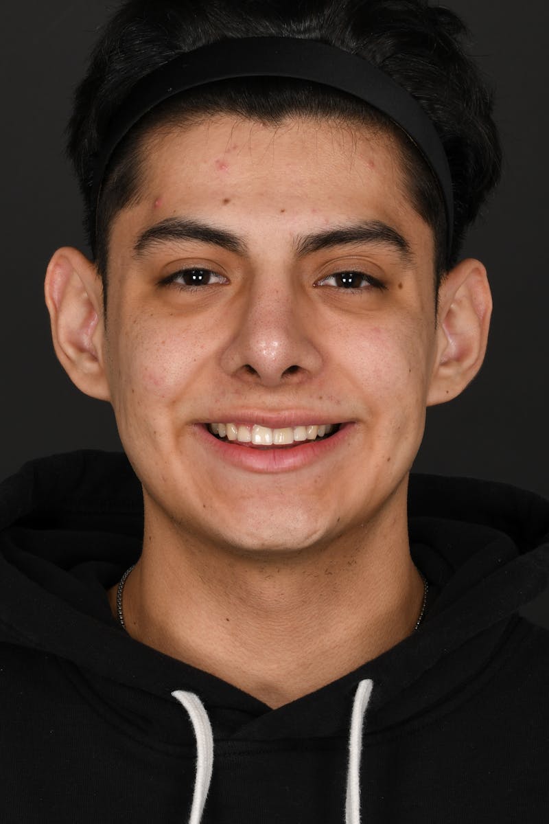 Rhinoplasty Before & After Gallery - Patient 335674 - Image 4