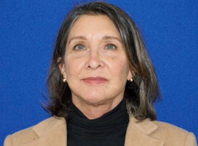 Upper Eyelid Surgery Before & After Gallery - Patient 805507 - Image 2