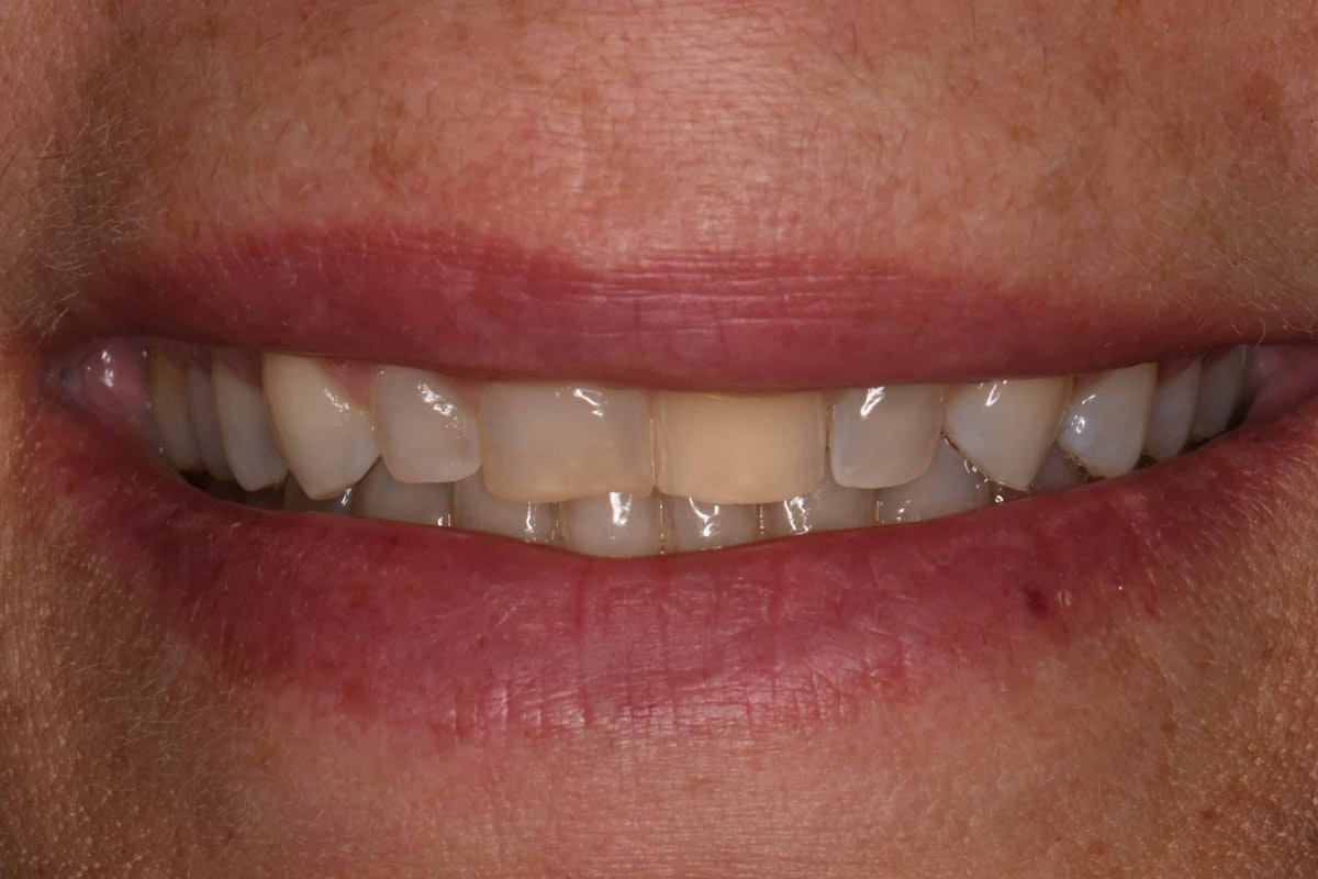 Smile before makeover