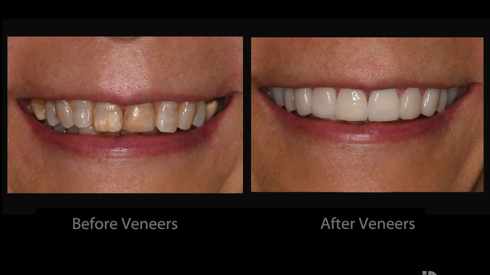 Cosmetic Before and AFter