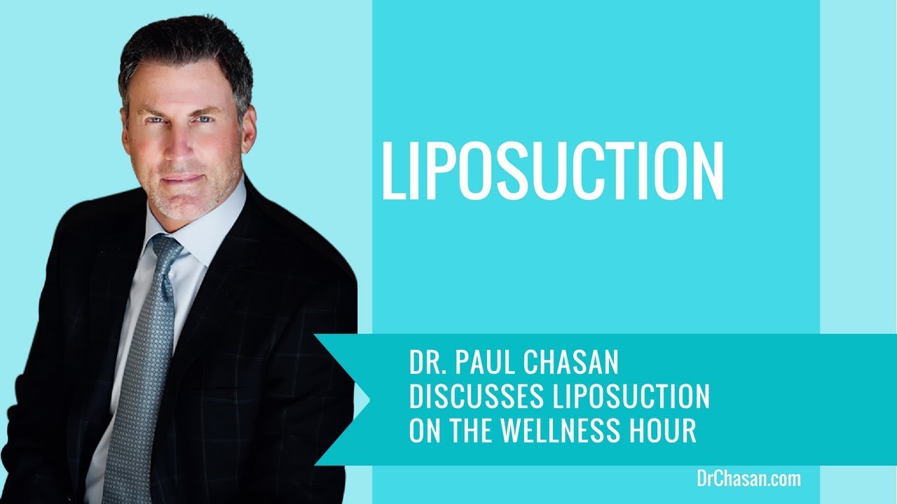 Dr. Chasan discussing liposuction