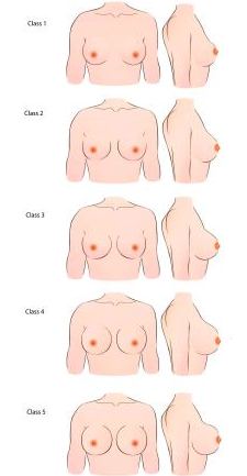 C Cup Boobs - Getting the Perfect Breast Augmentation