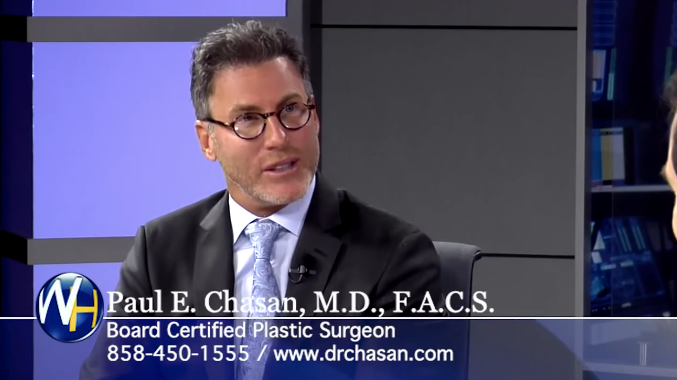 The Best CoolSculpting with San Diego Plastic Surgeon Dr. Paul E. Chasan, MD