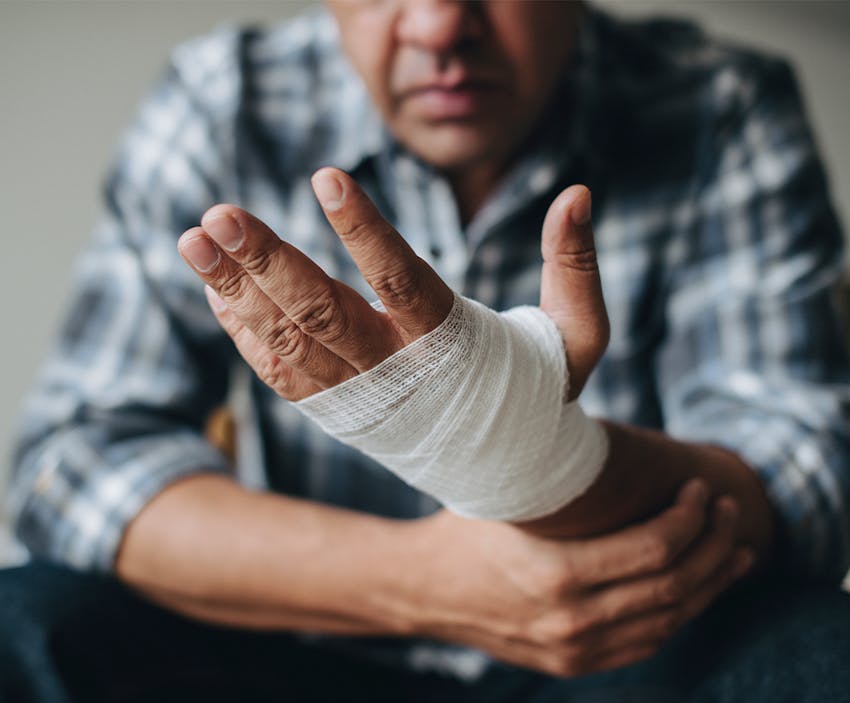 Man with an injured hand