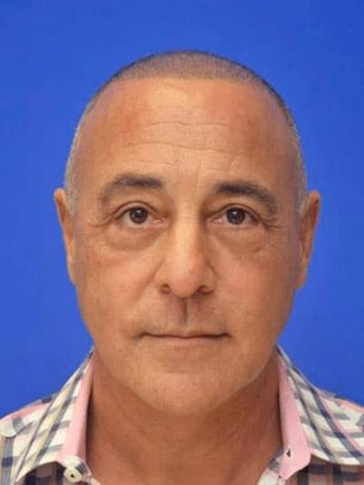 Blepharoplasty Before & After Gallery - Patient 135646 - Image 2